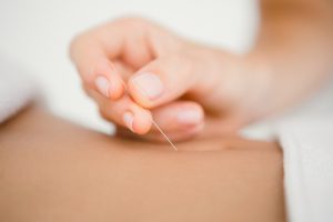 acupunctuur-chinese-geneeskunde-holistisch-buikpijn-pds