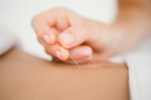 acupunctuur-amsterdam-holistisch-chinese-geneeskunde
